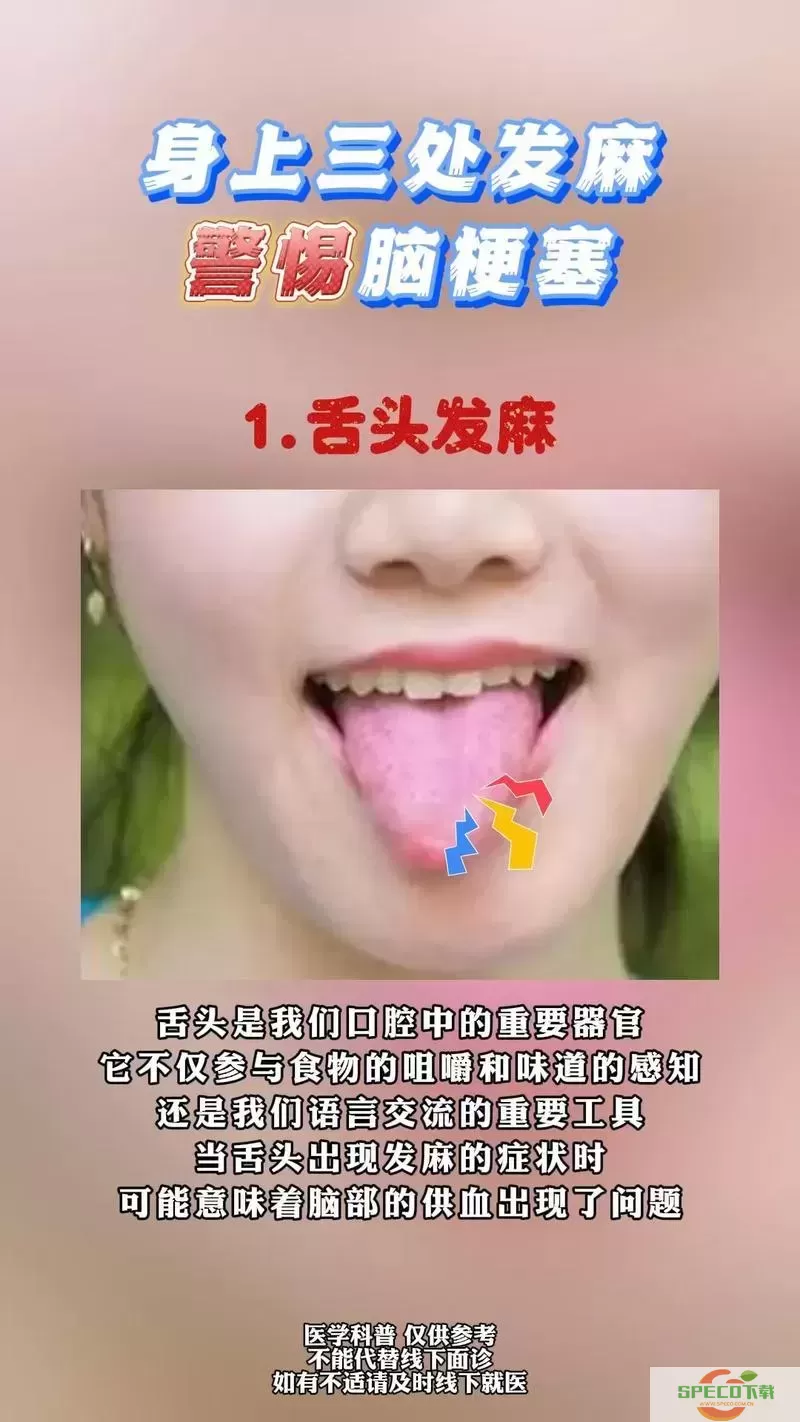 左右手发麻是什么病的前兆